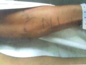 Salah satu ciri-ciri korban di lengan sebelah kiri terdapat tato abjad bertuliskan CNI - foto: Koranjuri.com